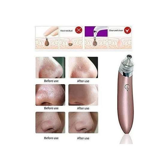 rechargeable black head remover rechargeable black head remover